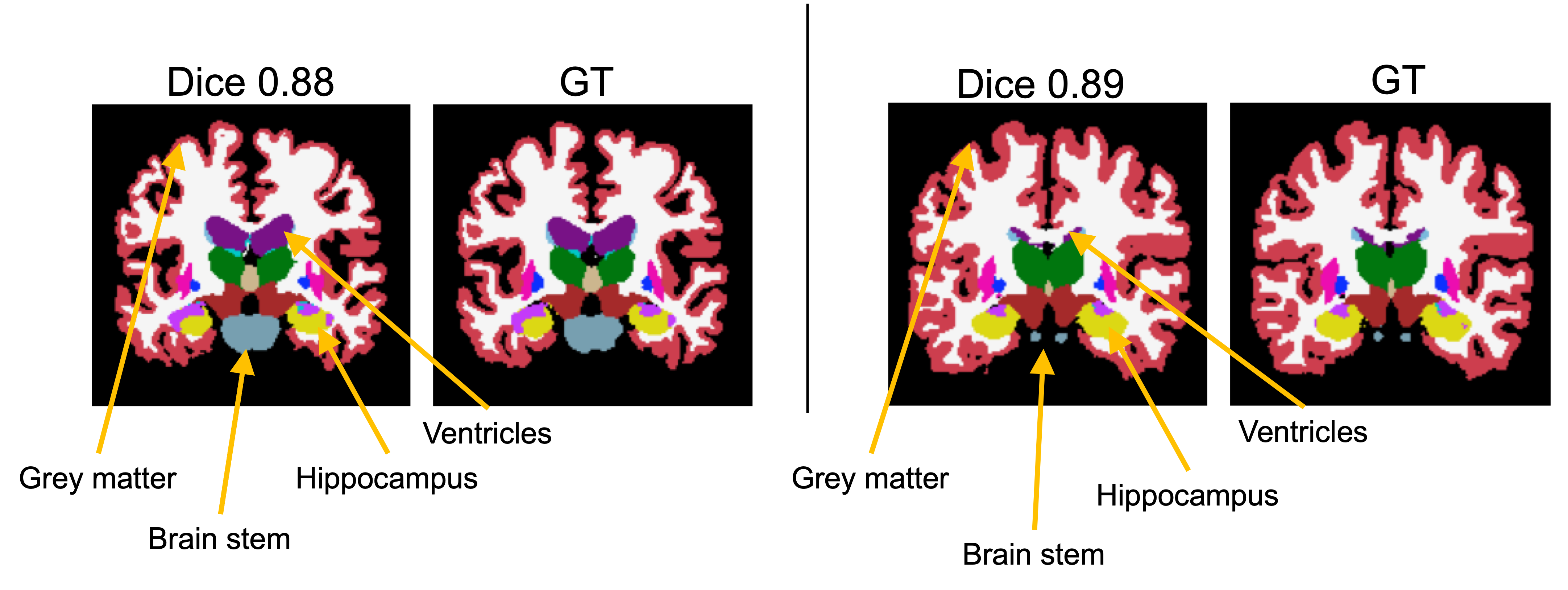 metaseg structures fig